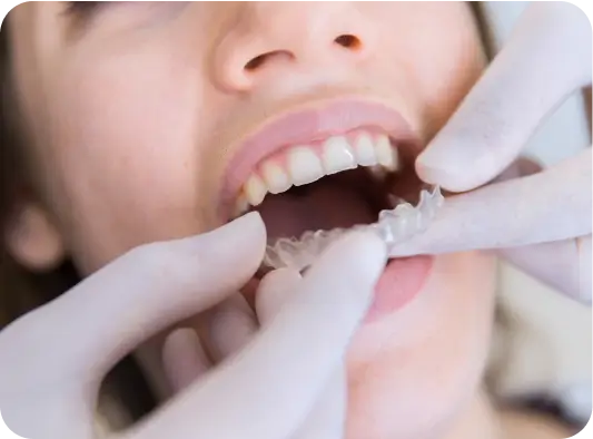 Warren - I'm wearing braces!